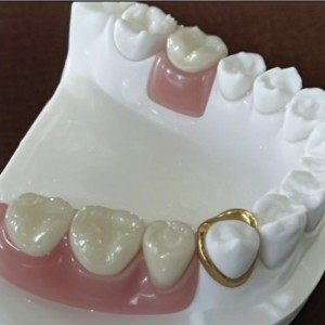 Precision připojení